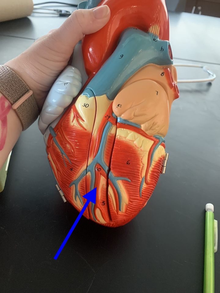 Name the heart structure.