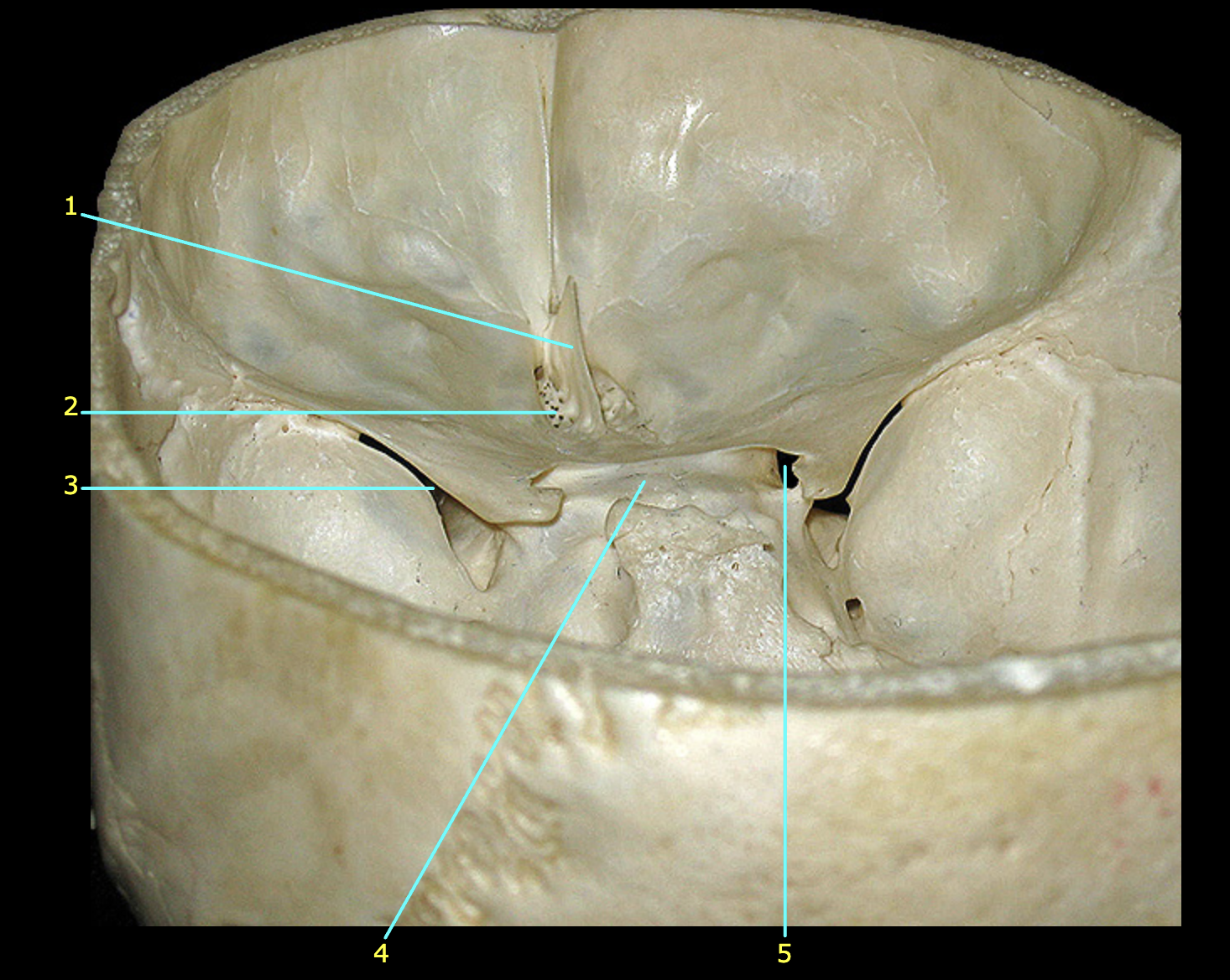What structure is labeled 1?