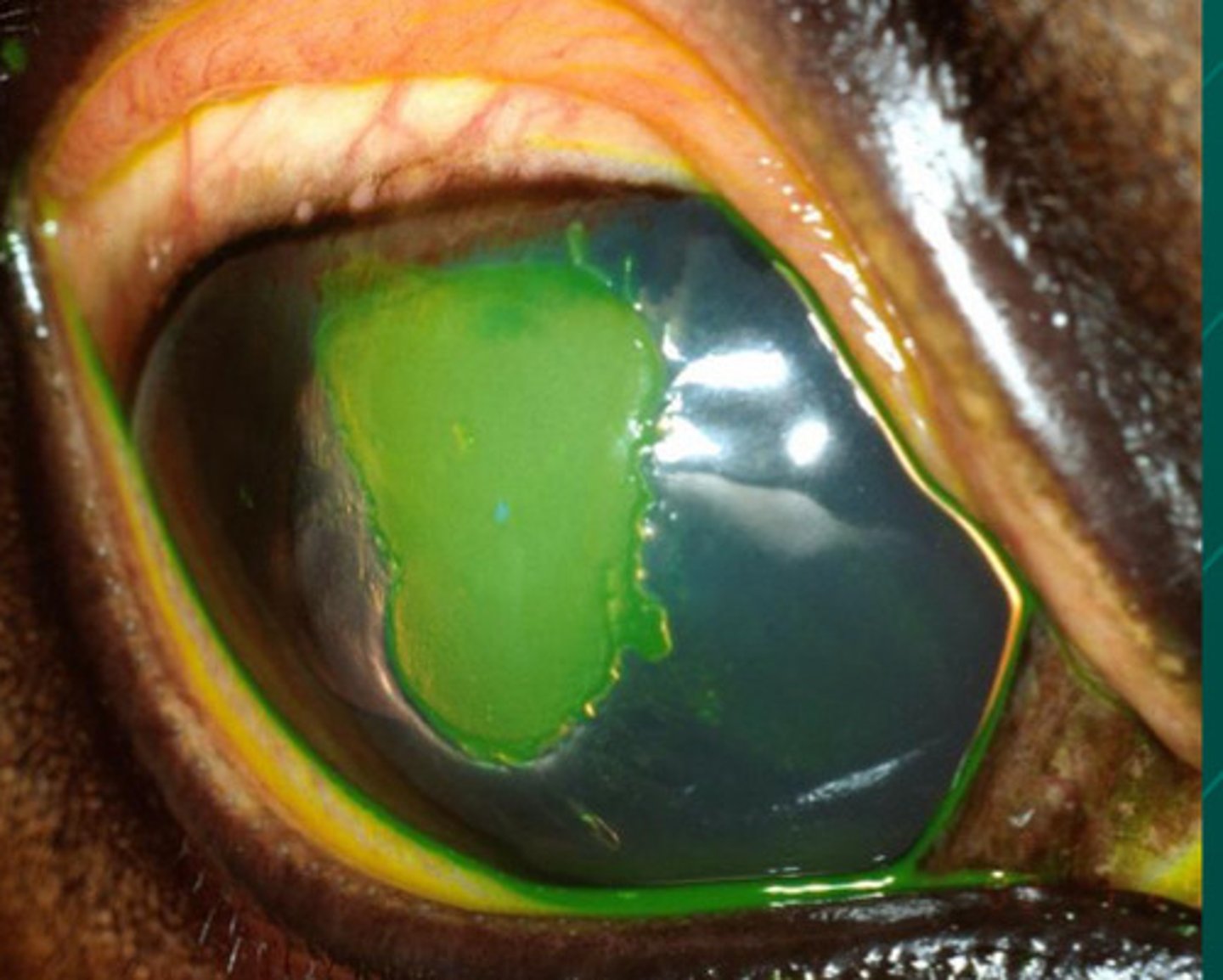 <p>Describe the edges of this lesion and what this means for debridement</p>