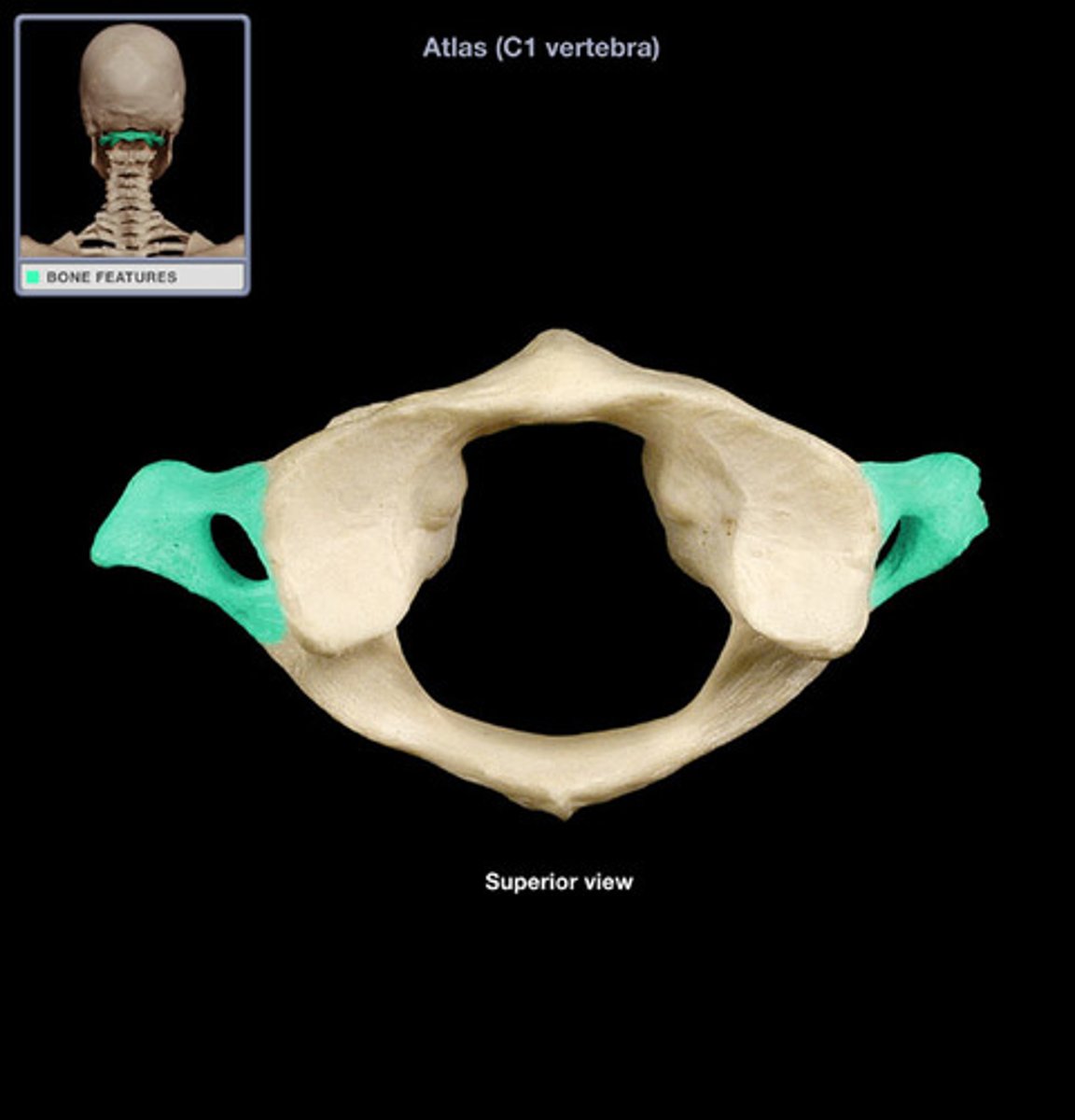 <p>(what vertebra and what structure is highlighted)</p>