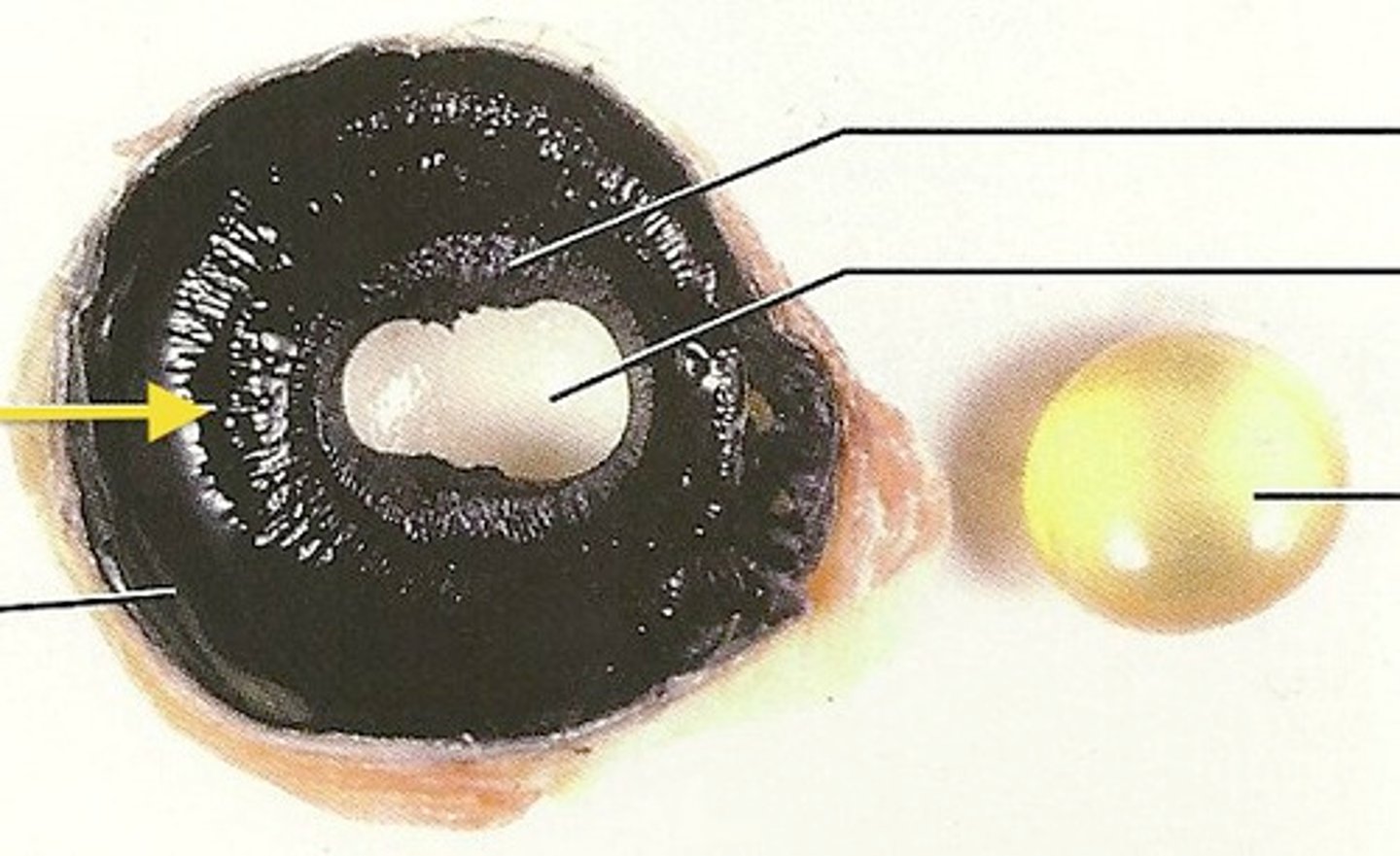 <p>black with "spokes"</p><p>anchors suspensory ligaments that flatten the lens for focusing your vision</p>