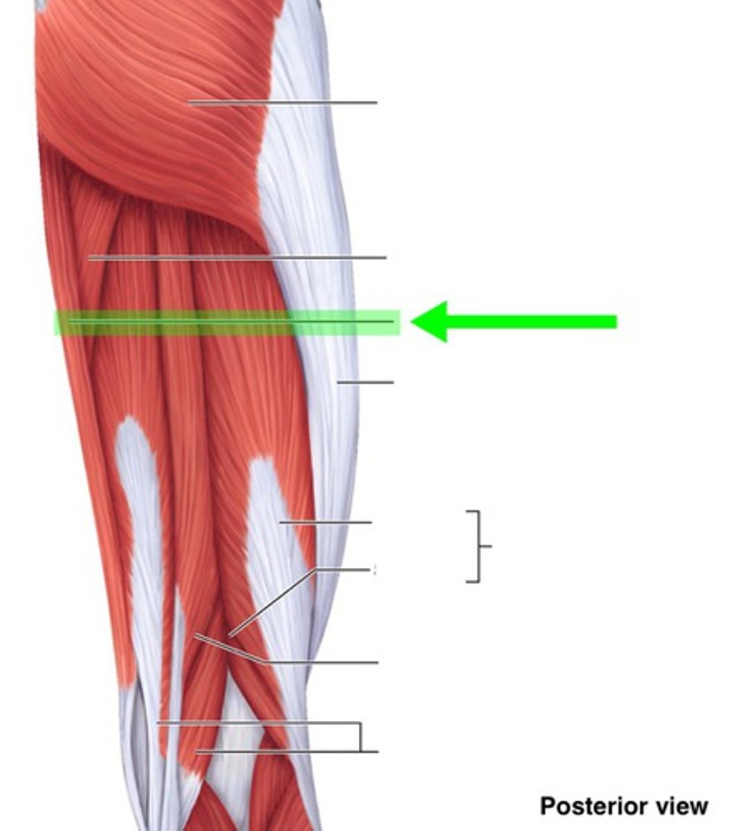 <p>What muscle is this?</p>