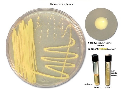 <p>Say the following about: Micrococcus Luteus&nbsp;</p><p>Growth Medium: </p><p>Pigment:  </p><p>is it diffusible: </p><p>Oxygen characteristics: </p>