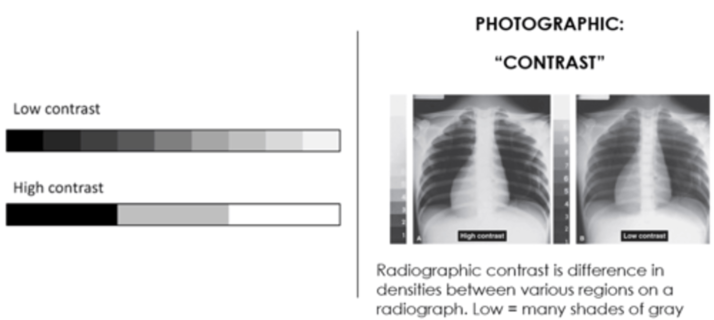 <p>The difference among various adjacent radiographic densities</p><p>Greater variation = high contrast</p><p>Less variation = low contrast</p>