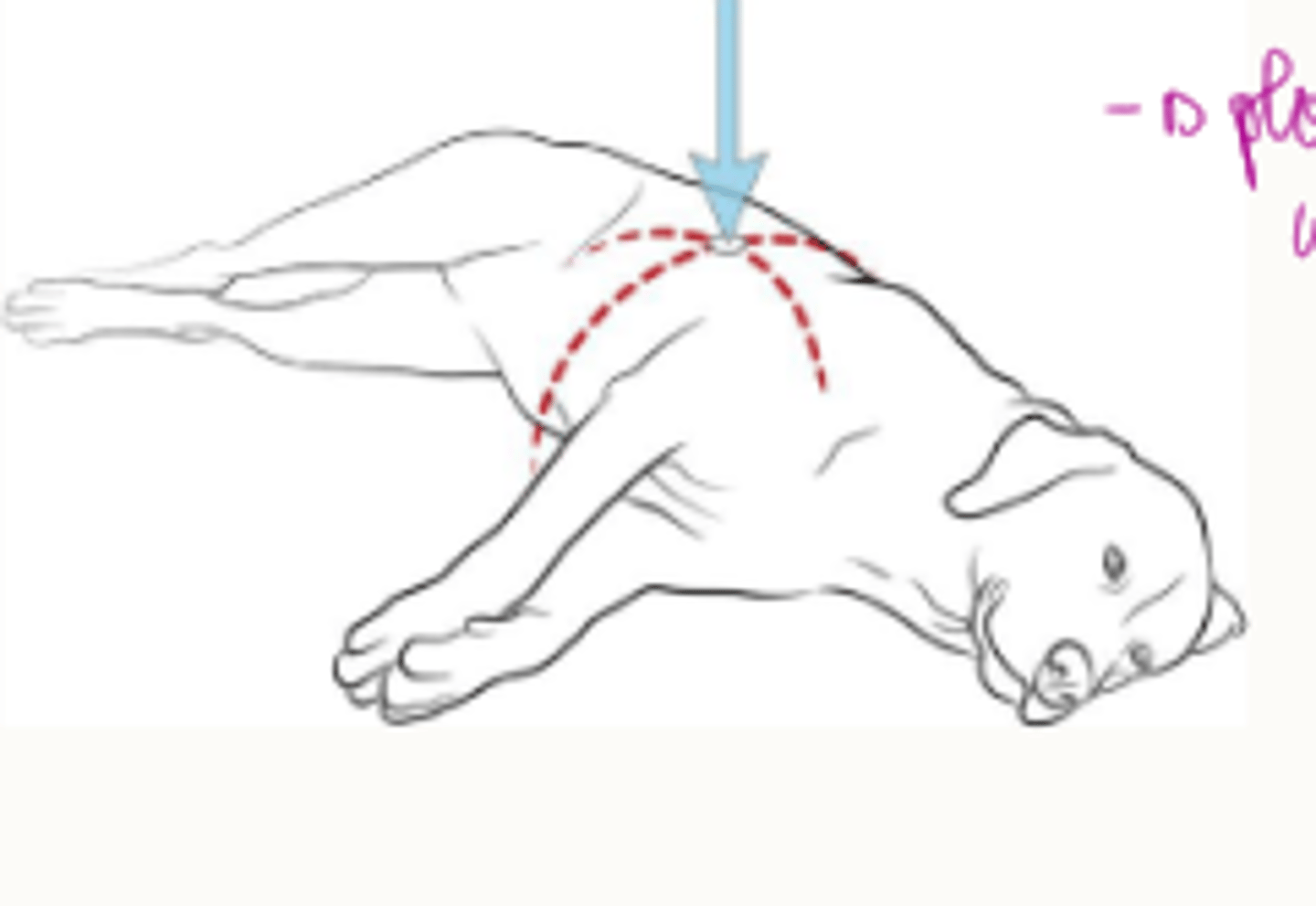 <p>-don't have the ability to compress directly over the heart because they've got a wider chest.</p><p>-place hand over widest part of chest</p><p>-or on their back if v wide chest</p>