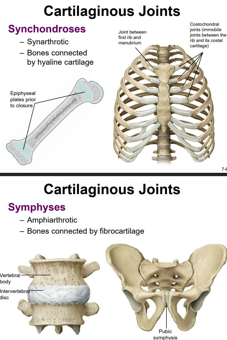 <ul><li><p>1) Synchondrosis joint (bone is united by a hyaline cartilage structure)</p><ul><li><p>ex. sternocostal joint, epiphyseal plate, joint b/t first rib &amp; manubrium, costochondral joints (joints b/t the rib &amp; its costal cartilage)</p></li></ul></li><li><p>2) symphysis (bones joined by fibrocartilage)</p><ul><li><p>ex. vertebral body’s intervertebral disc, pubic symphysis</p></li></ul></li></ul><p></p>