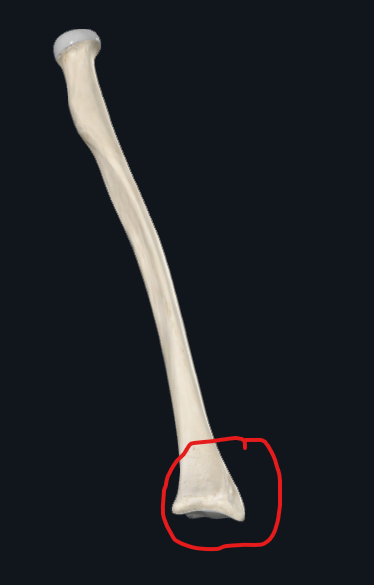 <p>What is this part of the radius called?</p>