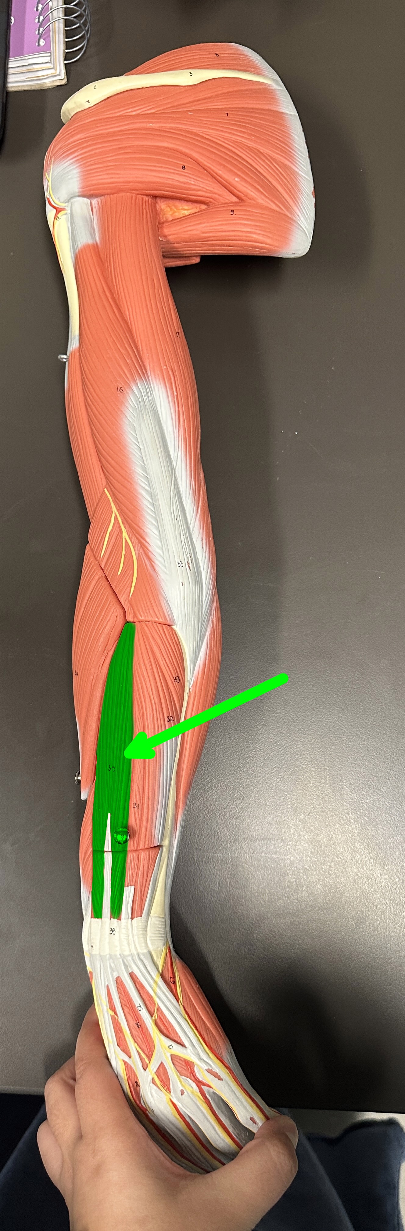 <p>What is the highlighted structure</p>