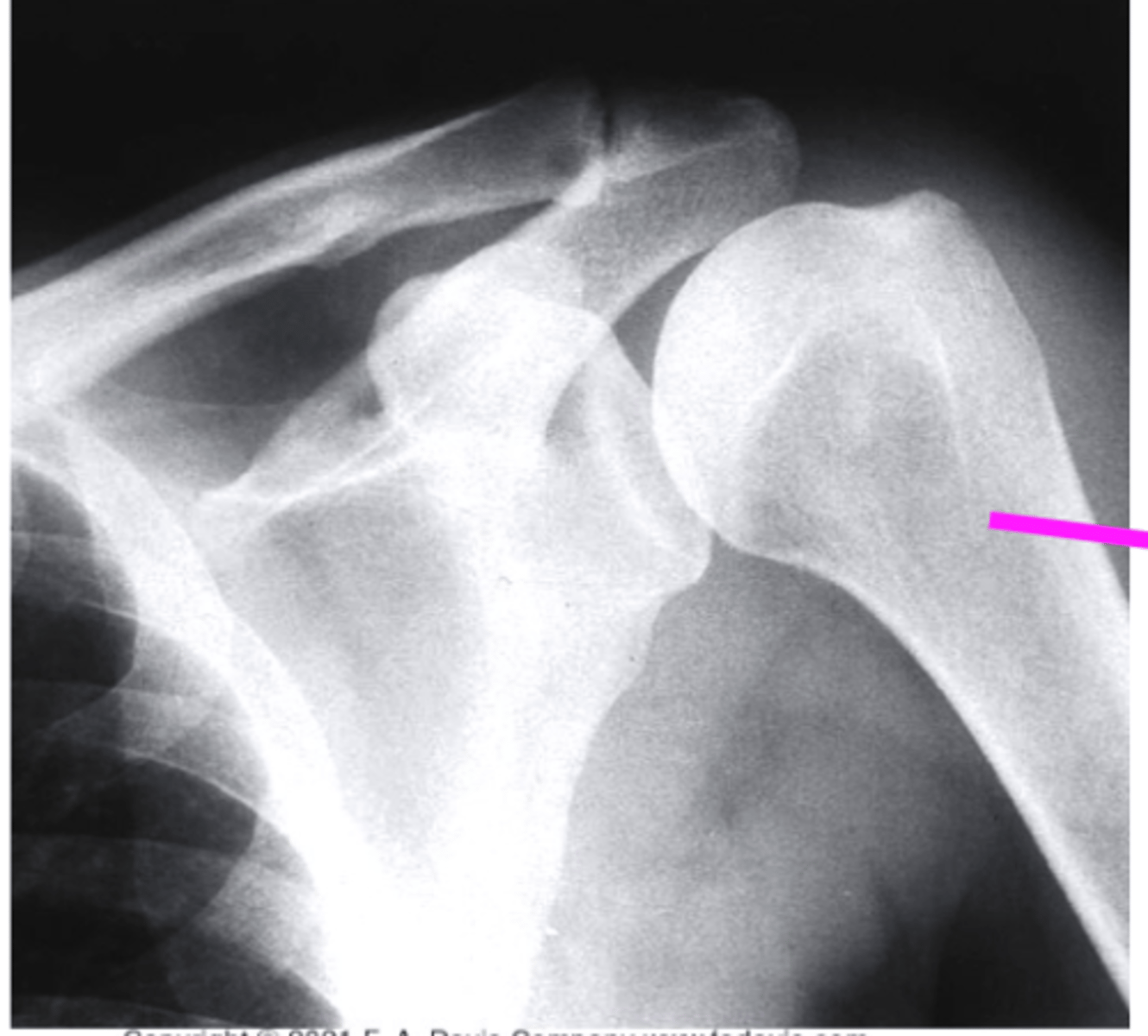 <p>what does the pink line point to?</p>