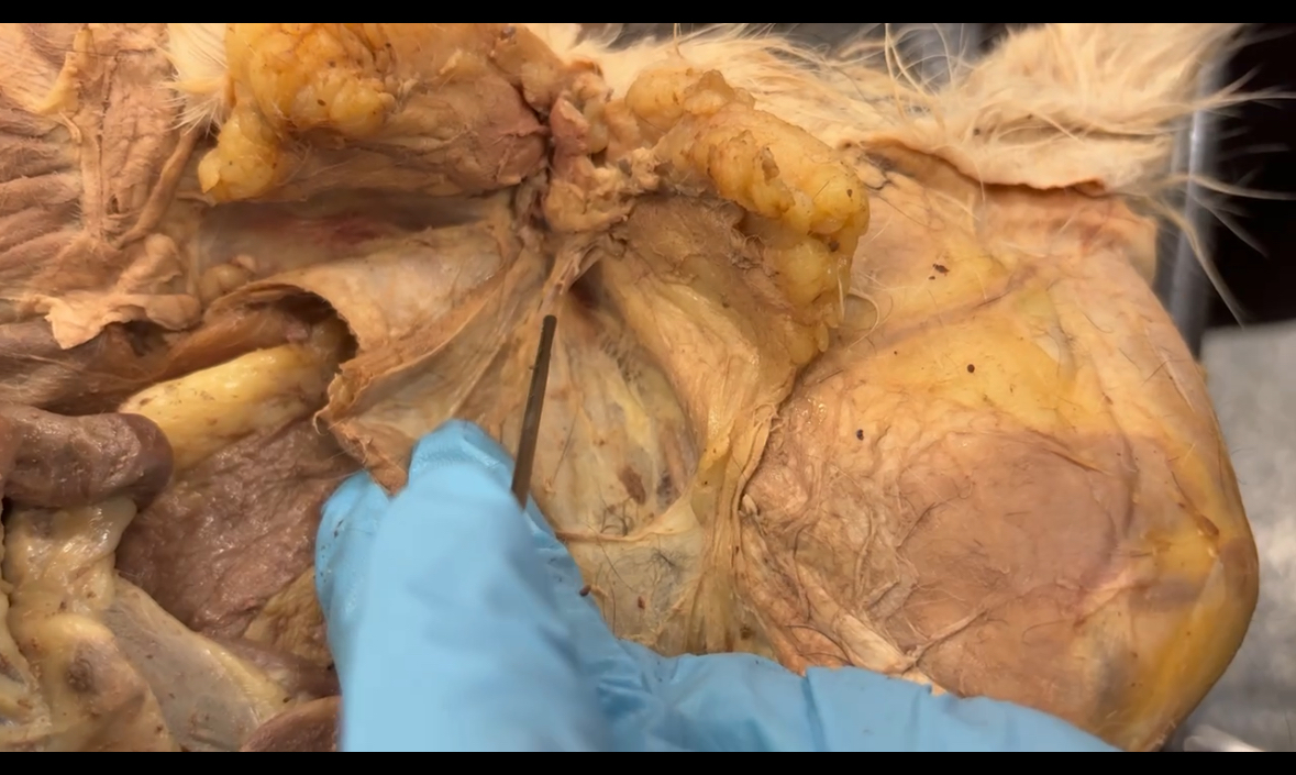 <p>Where vas deferens goes through to other side of fat</p>