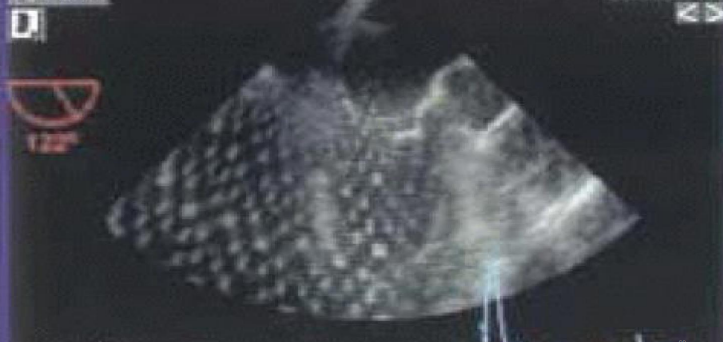 <p>what is this type of artifact?</p>