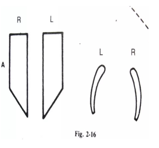 <p>(Single-beveled instruments: spoon excavator, gingival margin trimmers, enamel</p><p>hatchets)</p>
