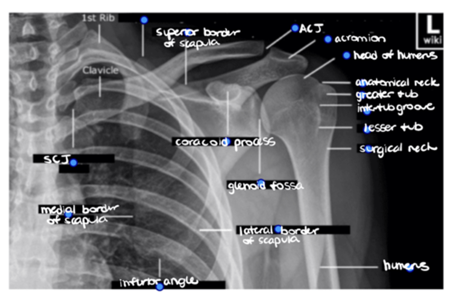 <p>ID the missing structure.</p>