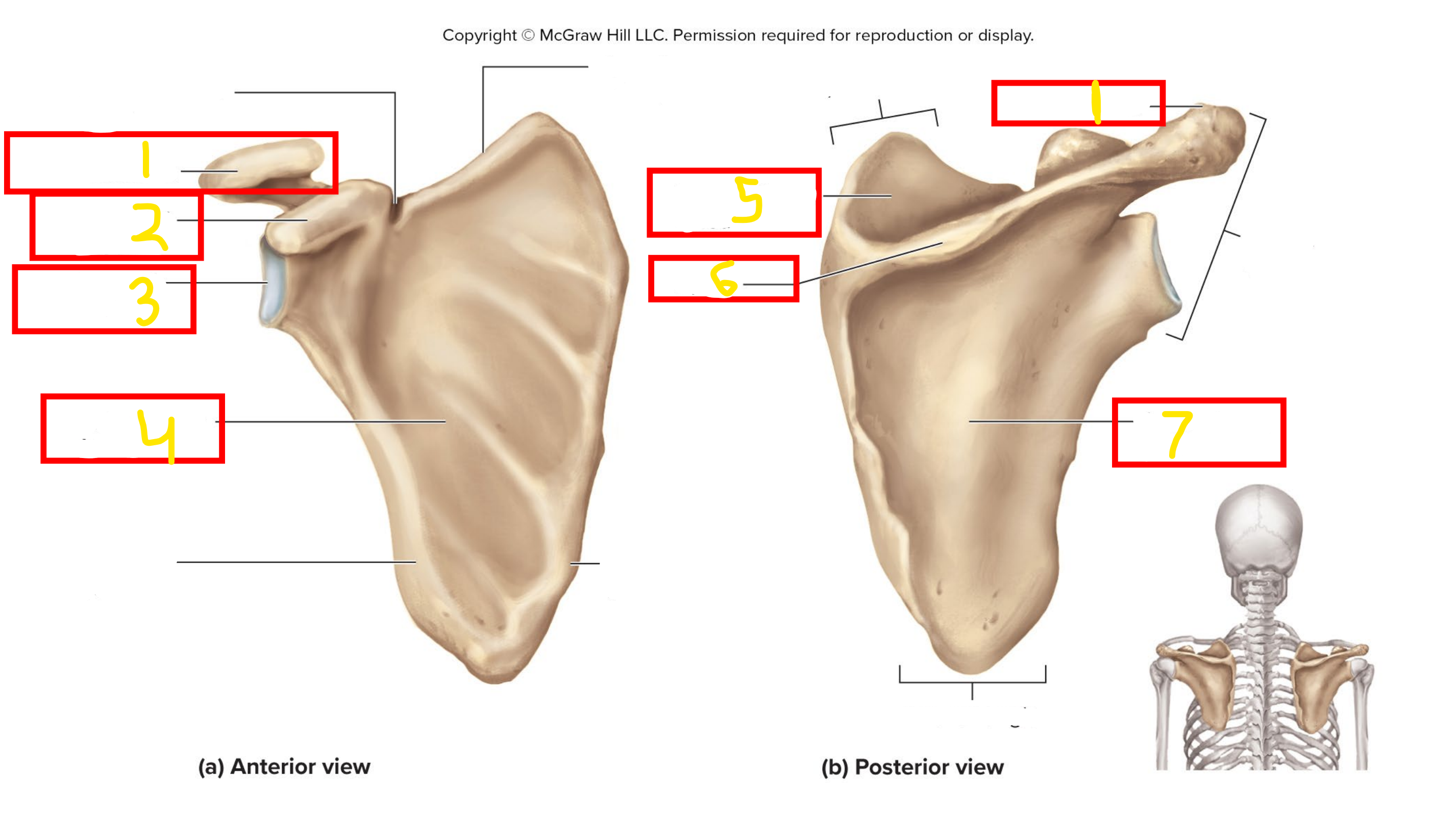 <p>What bone is this</p>