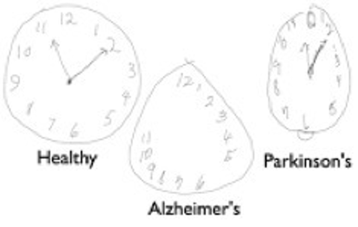 <p>quick screening test of executiive function/visual-spatial</p><p>-does NOT test memory, less stressful, less culture based</p>