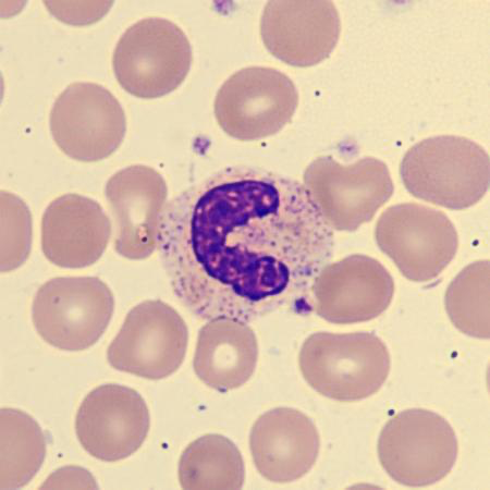 <p>What is this leukocyte?</p>