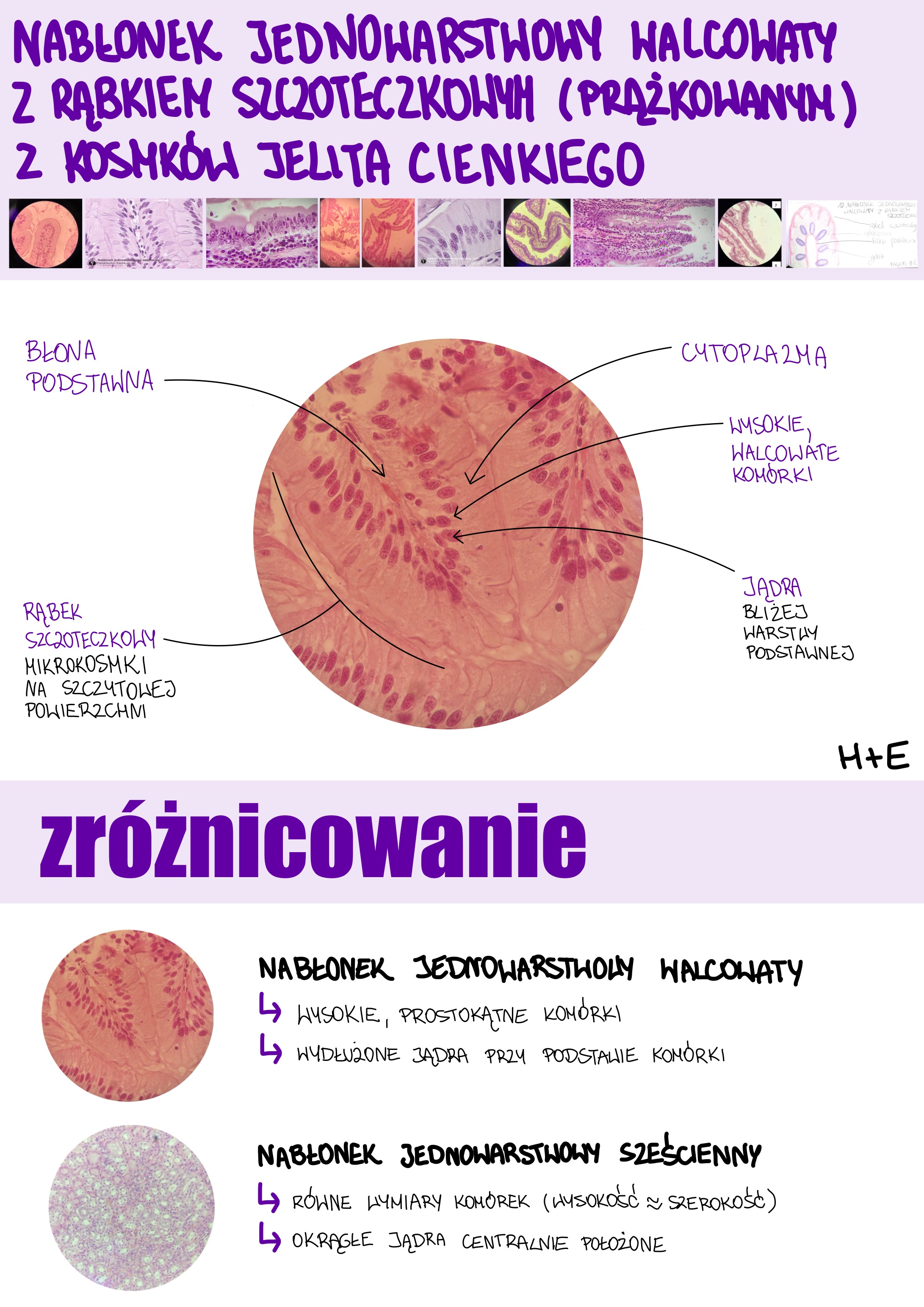 <p>Nabłonek jednowarstwowy walcowaty z rąbkiem szczoteczkowym (prążkowanym) z kosmków jelita cienkiego</p>