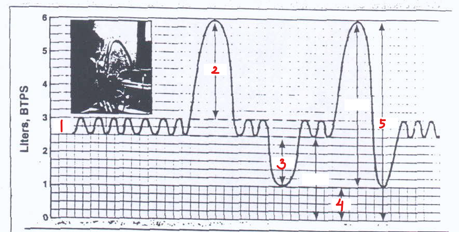 <p>Which is labeled <strong>4</strong>?</p>