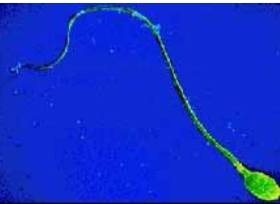 <p>Estructuras largas pero de menor número que permiten el movimiento de la célula en líquidos. Se mueven de forma circular (como nos mostro yoli en clase)<br><br>(en eucariotas tienen estructura de 9 microtubulos encirculando 2 otros a lo que se le llama estructura 9+2)</p>