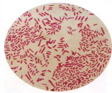 <p>What Bacterial Arrangement?</p>
