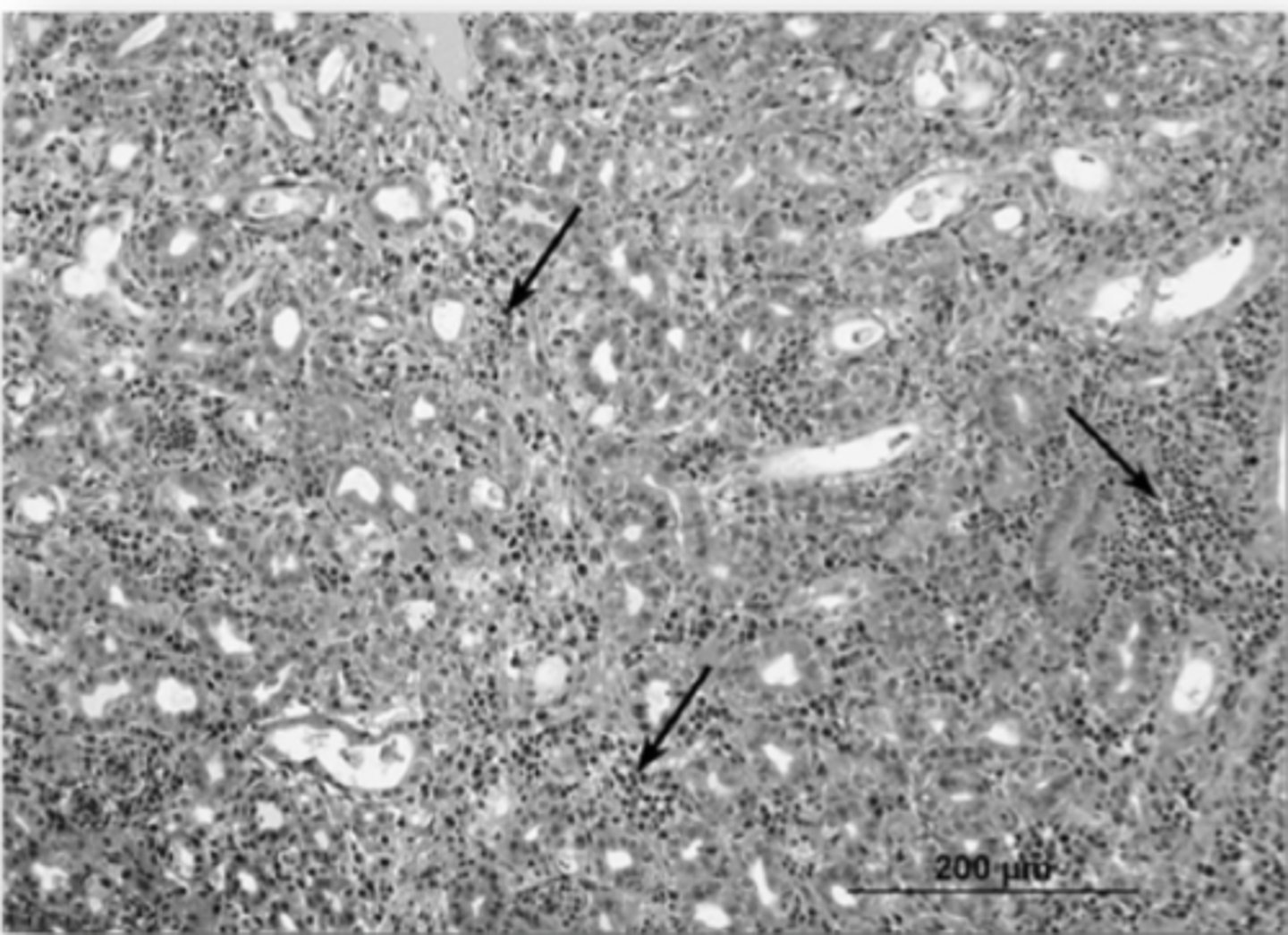 <p>1. Histological Change of Kidneys<br>2. RT-PCR</p>