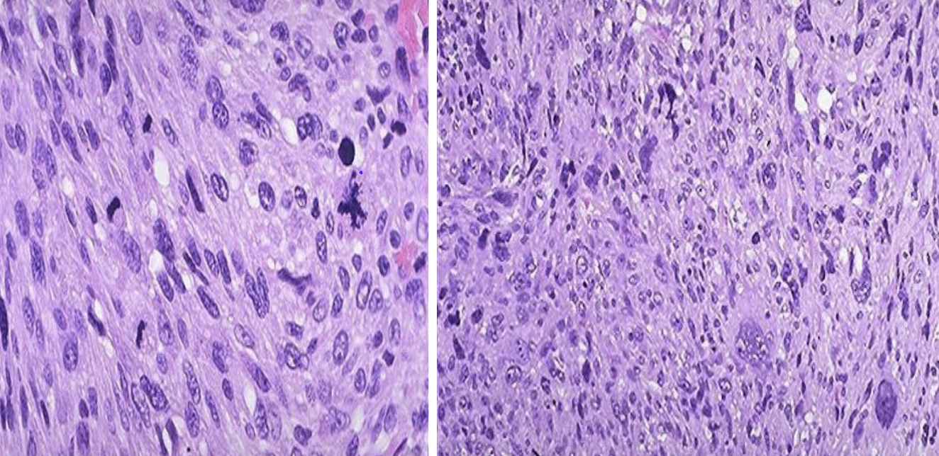 <p>Identify the <strong>organ</strong> and the <strong>diagnosis</strong> in this format: <em>diagnosis, organ</em></p>