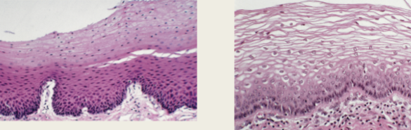 <p> Skin, oral cavity, esophagus, and vaginal</p><p>contains keratin</p><p>Multiple layers of flat egg-shaped cells.</p>