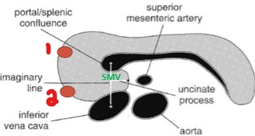 <p>What are the two small vessels that can be seen to the right of the pancreatic head?</p>