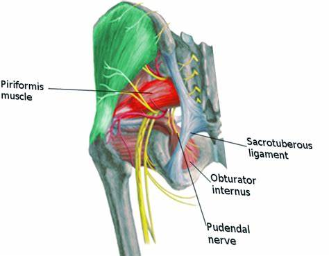 <p>Pudendal nerve:</p><p>A. passes above the piriformis muscle F</p><ul><li><p><strong>pudendal nerve passes <u>below the piriformis</u> muscle</strong>, not above. It exits the pelvis through the <strong>greater sciatic foramen below the piriformis</strong> and re-enters through the <strong>lesser sciatic foramen</strong></p></li></ul><p>B. passes through lesser sciatic foramen T</p><p>C. is a branch of the sacral plexus T</p><p>D. supplies the medial surface of the thigh F</p><ul><li><p>Instead, it supplies the <strong>perineum</strong>, including the external genitalia, anus, and surrounding areas. </p></li><li><p>The <strong>obturator nerve</strong> is responsible for the medial thigh</p></li></ul><p>E. innervates the perineum T</p>
