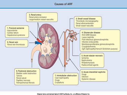 -Parenchymal renal disease: *acute tubular necrosis* (most common- often after vascular surgery), cortical necrosis, acute glomerulonephritis, microvascular disease, allograft rejections, or interstitial disease
•aminoglycosides (neomycin, gentamycin, tobramycin)
•*radiocontrast media*
•chemotherapy - Cisplatin