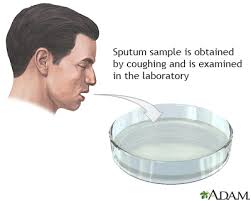 <p>When collecting a sputum sample, what should the nursing assistant ensure?</p>