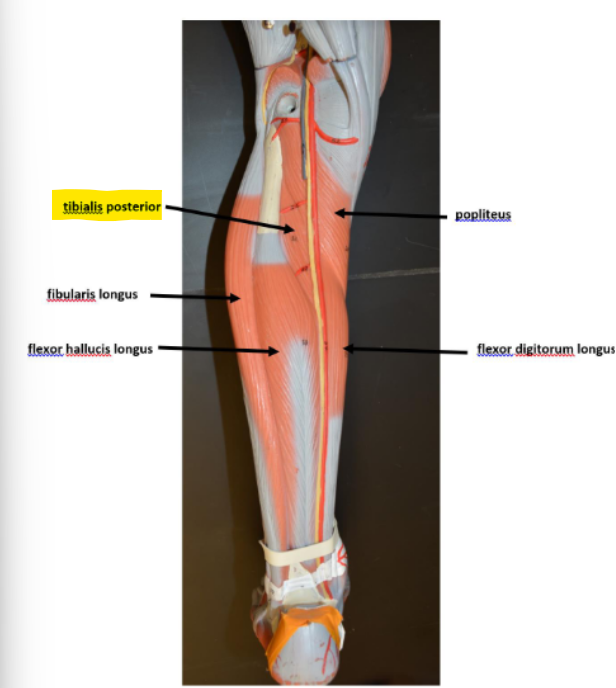 <p>Tibialis Posterior</p>