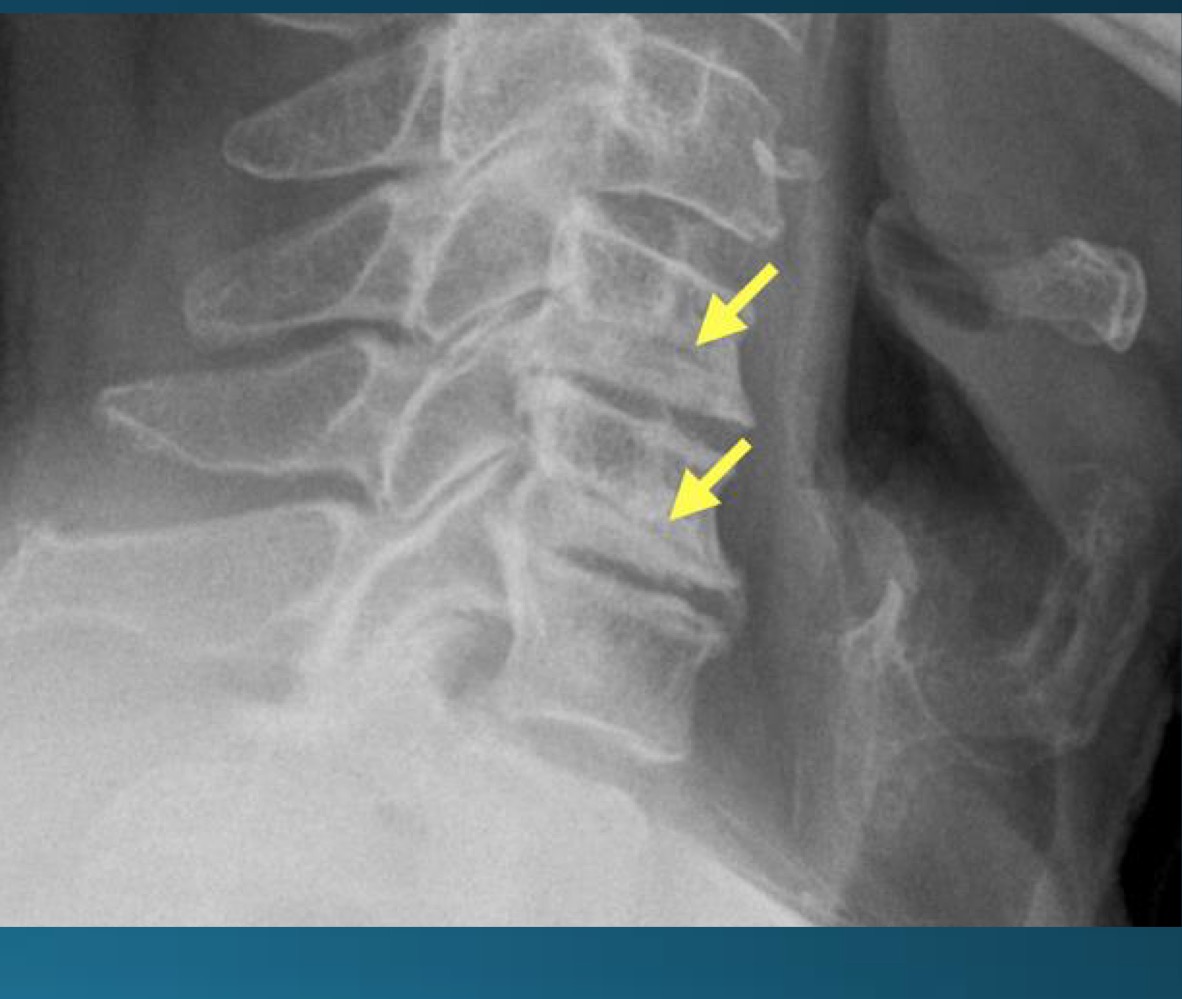 <p>what are the findings in this image? </p>