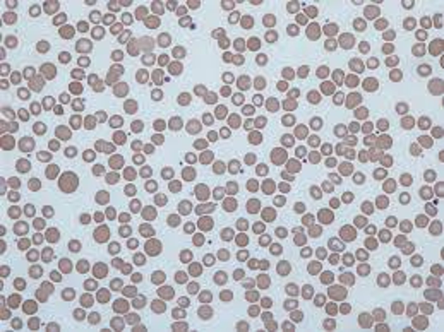 <p>- anisocytosis</p><p>- can indicate regnerative anemia, liver or kidney disease, cancer, nutrient deficiency</p>