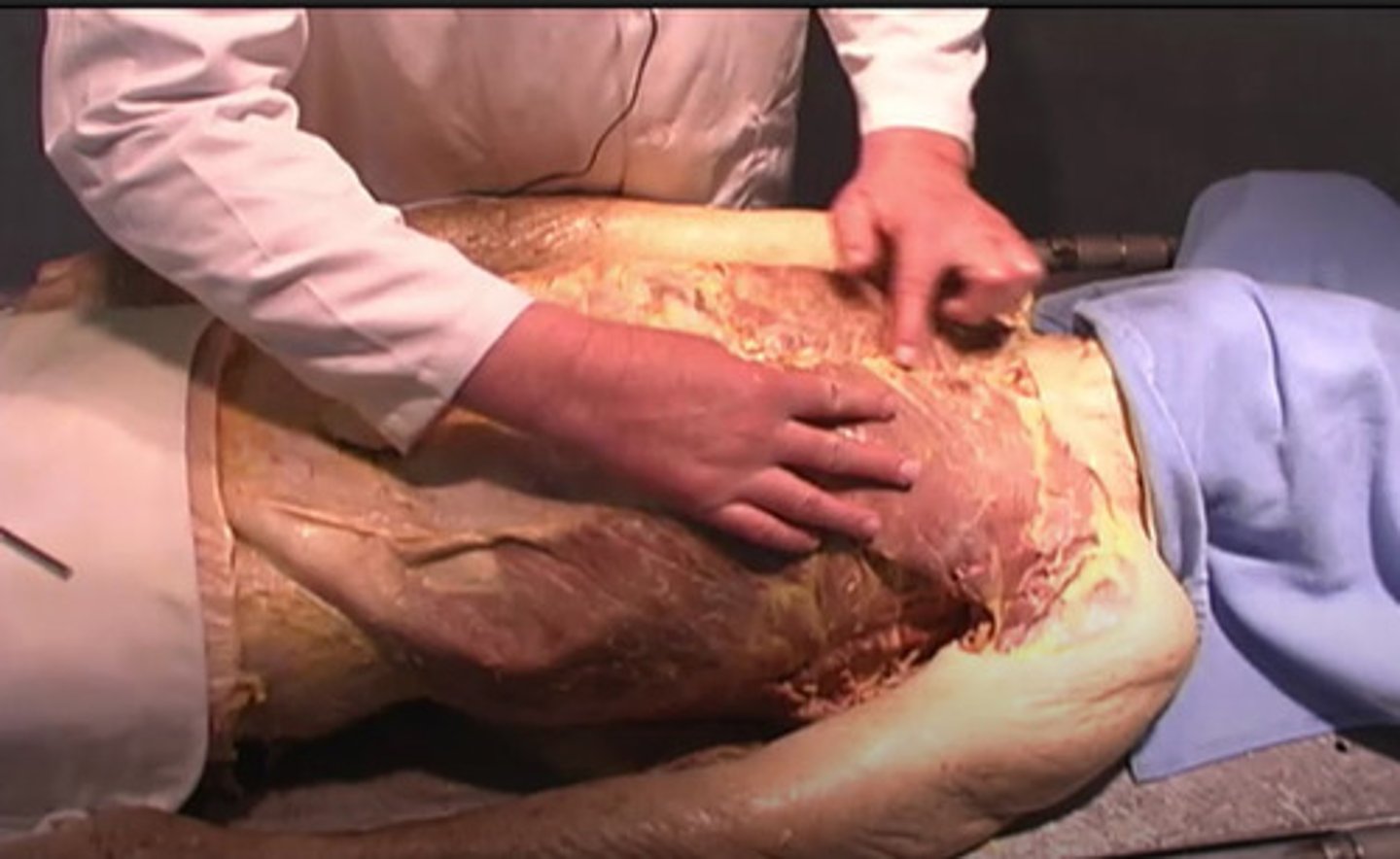 <p>What is the purpose of removing the pectoralis major?</p><p>cutting off the ribs</p><p>detaching the xiphoid process</p><p>cutting off the muscle from the underlying ribs</p><p>removing the spine</p>