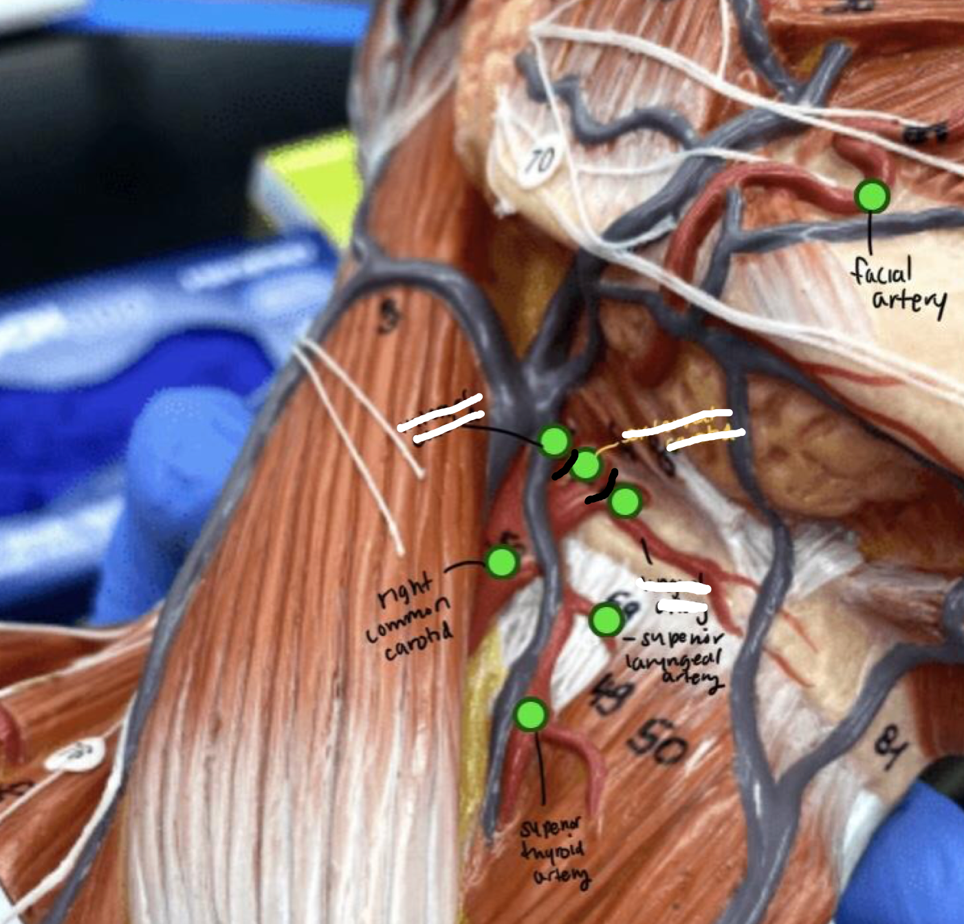 <p>Short upper part of the red neck artery</p>