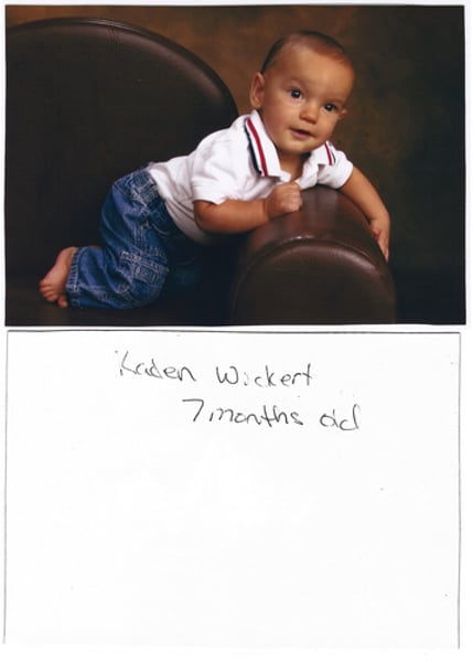 <p>Fetal alcohol syndrome</p>