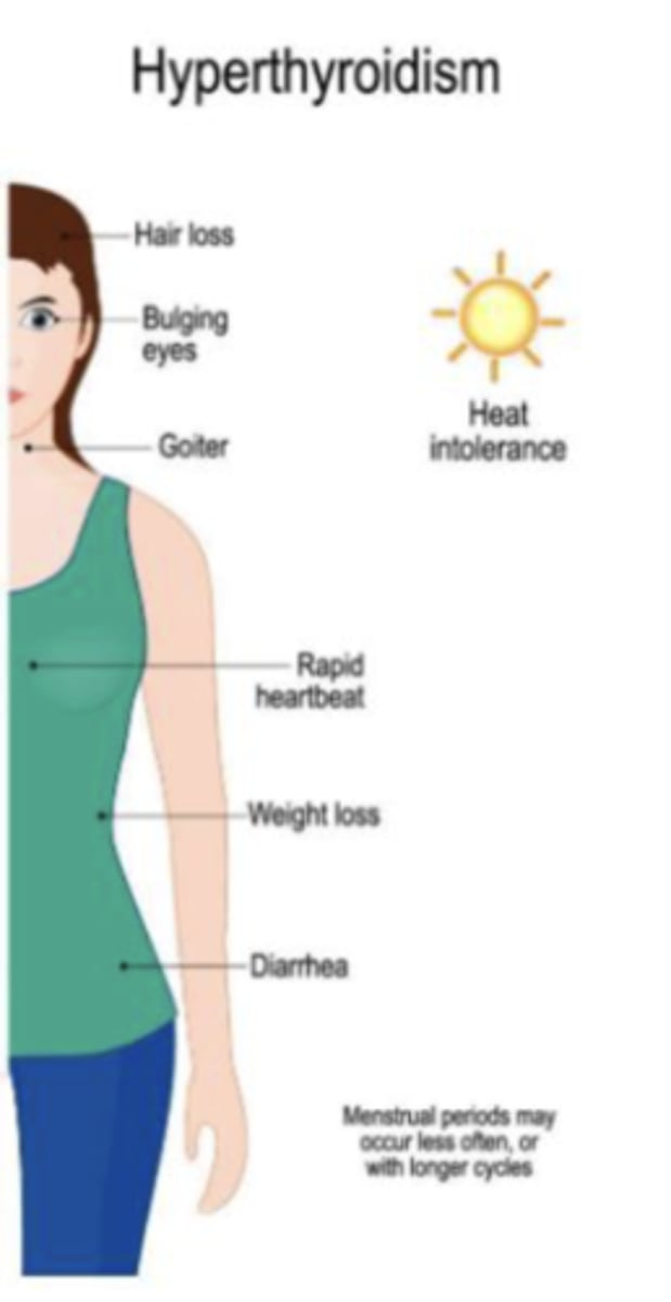 <p>- hair loss</p><p>- bulging eyes</p><p>- goiter</p><p>- rapid heart beat</p><p>- weight loss</p><p>- diarrhea</p><p>- heat intolerance</p><p>- menstrual periods may occur less often, or with longer cycles</p>