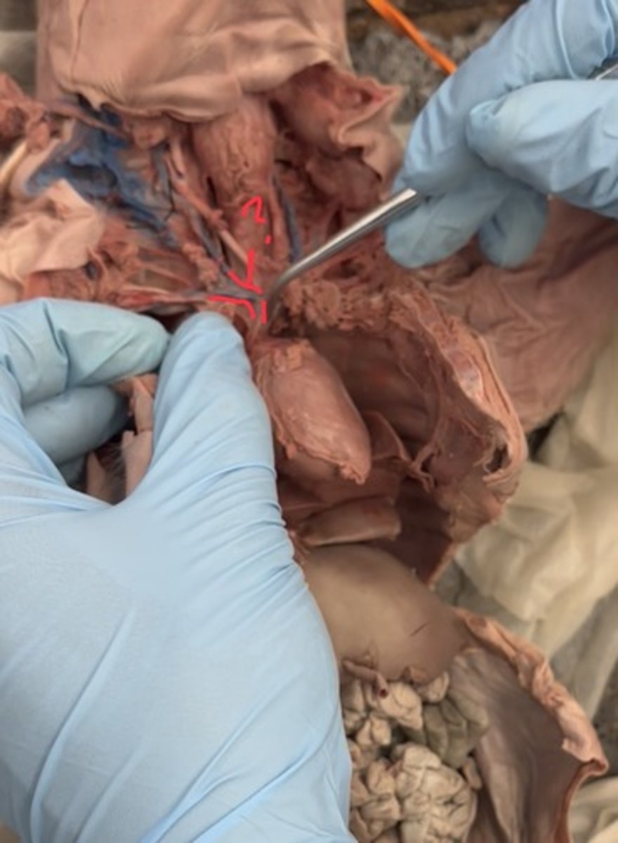 <p>head neck and upper limbs</p>