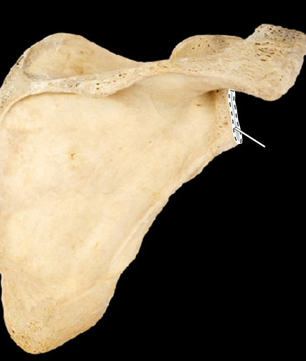 <p>Scapula, posterior view, right side</p>