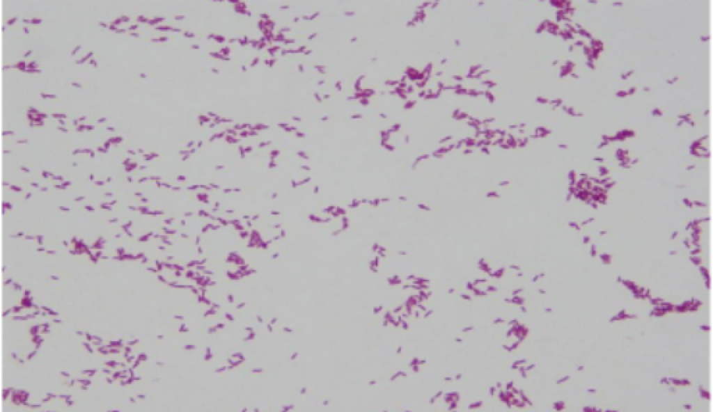 <p>What stain and what does it say about the bacteria?</p>