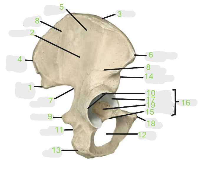 <p>Where is the acetabulum </p>