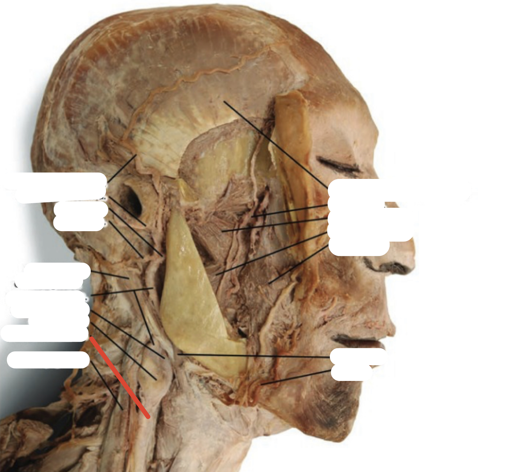 Identify the structure (red line)
