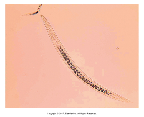 <ul><li><p>Facultative parasites — usually live in soil​</p></li><li><p>L1 larvae get in through skin — red, crusty, loss of hair where inflamed​</p></li><li><p>Larvae can be seen on skin scraping, even on cattle​</p></li><li><p>L1 can look like microfilariae of D. immitis if taken from a bloody skin scraping</p></li></ul><p></p>