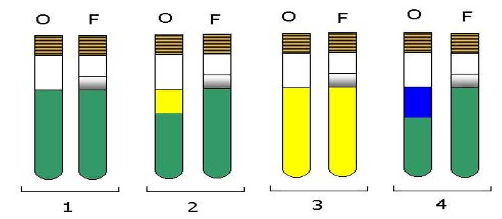 <p><span style="font-family: "Times New Roman";"><strong><span>Oxidative Fermentative (OF) Medium Test</span></strong></span></p>