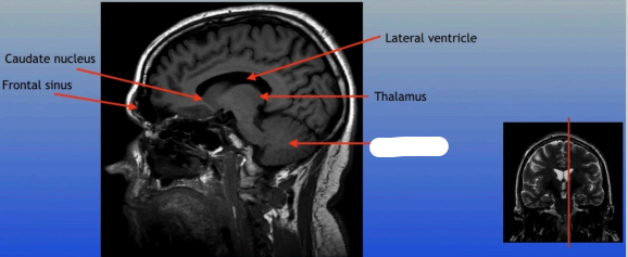 <p>A large structure located at the back of the brain responsible for coordination, balance, and fine motor control. </p>