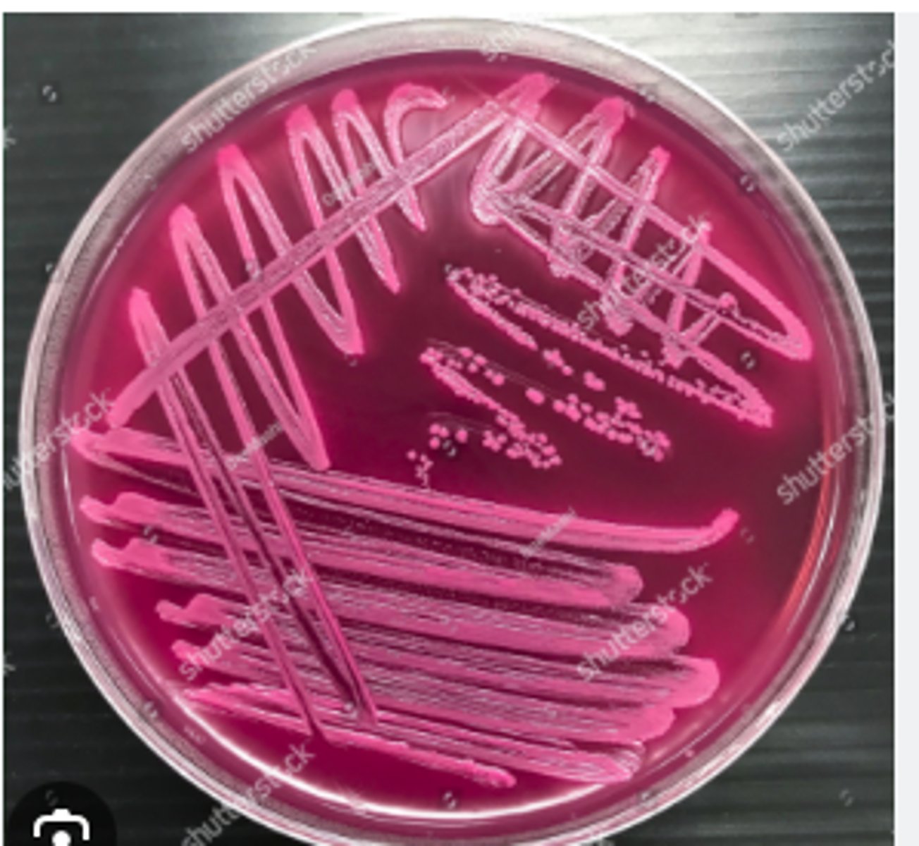 <p>A dog shows dysuria, hematuria, and frequent urination. Urine cytology contains </p><p>Tests:</p><p>Cytology Gram-negative rods</p><p>Blood agar shows gray colonies; </p><p>See MacConkey Agar </p><p>Indole is positive.</p>