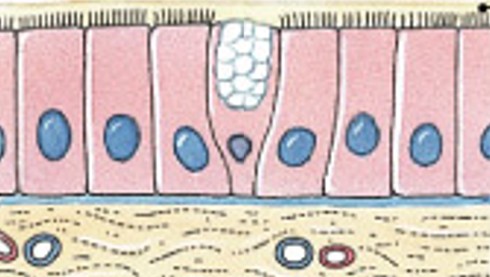 <p>Which type of membrane has:</p><ul><li><p>Line passageways that have external connections</p></li><li><p>Also in digestive, respiratory, urinary, and reproductive tracts</p></li></ul><p></p>