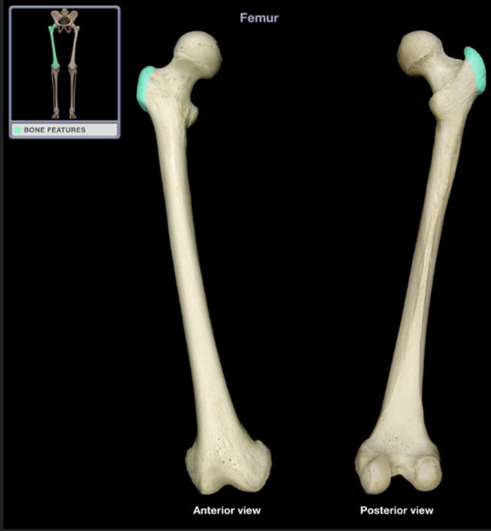 <p><span style="font-family: Arial, sans-serif; color: rgb(45, 59, 69)">large prominence lateral to the femoral head</span></p>
