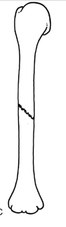 <p><strong>Which fracture?</strong></p>